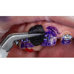 Индикатор биопленки Biofilm Discloser (250 губок) EMS