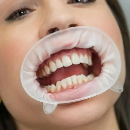 Оптрагейт  small (1шт) IVOCLAR (OptraGate)