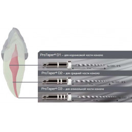 ПроТейпер машинный для распломбировки каналов D3 (6 шт/уп) Dentsply
