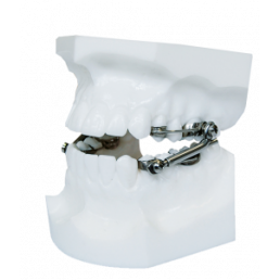 Аппарат Гербста №1 Dentaurum