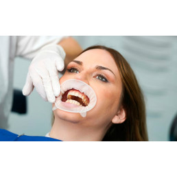 Оптрагейт 2 small (1 шт) IVOCLAR (OptraGate 2)