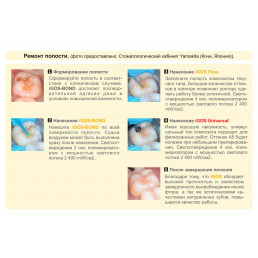 Айгос Бонд (5 мл) Бондинг жидкий с высокой адгезией во влажной среде, Ямакин (YAMAKIN iGOS-Bond)