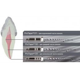 ПроТейпер машинный для распломбировки каналов D3 (6 шт/уп) Dentsply — фото №2