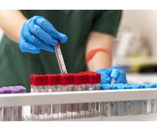 Минпромторг ограничит на рынке госзаказа закупку импортных вакуумных пробирок для венозной крови 