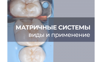 Применение матричных систем в стоматологии