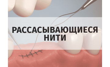 Рассасывающиеся шовные нити: классификация и применение в стоматологической хирургии