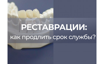 Почему пломбы не служат вечно: факторы, влияющие на срок службы пломб и реставраций