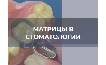 Классификация стоматологических матриц: виды и особенности применения