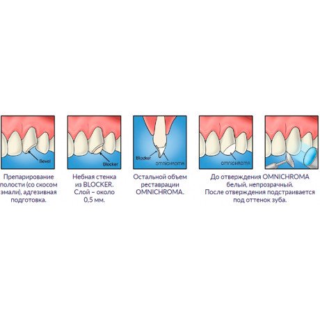 Омнихрома шпр. 4 г (2,1, мл) реставрационная система из одного шприца, Tokuyama (Omnichroma)  — фото №1