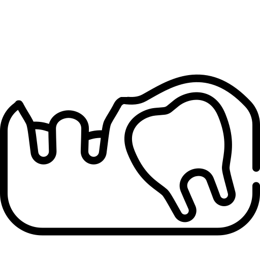 Для удаления верхушек корней и зубов мудрости