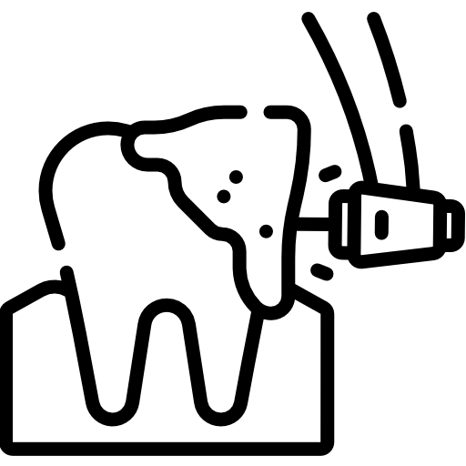 Бор для обработки композитных пломб