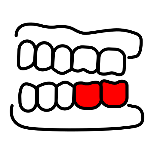 Для удаления нижних левых моляров