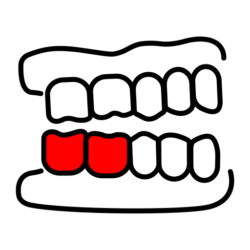 Для удаления нижних правых моляров