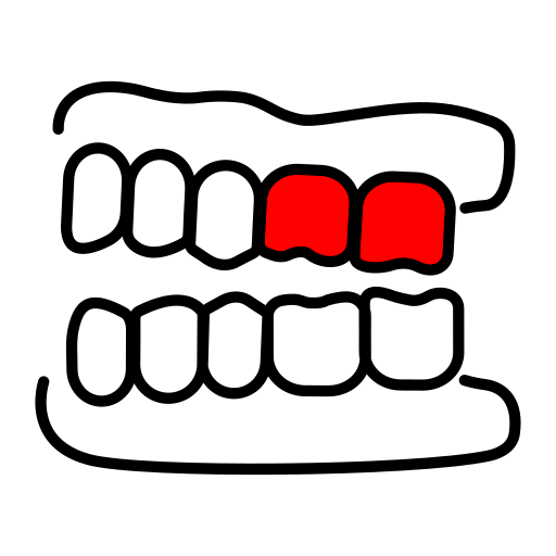 Для удаления левых моляров верхней челюсти