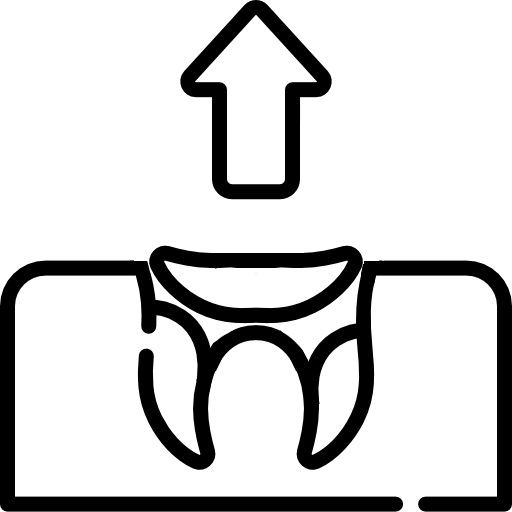 Фреза для удаления остатков корней и грануляционной ткани