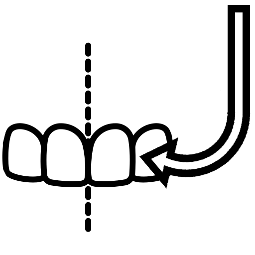 Эмалевый топорик для дистальных поверхностей зуба