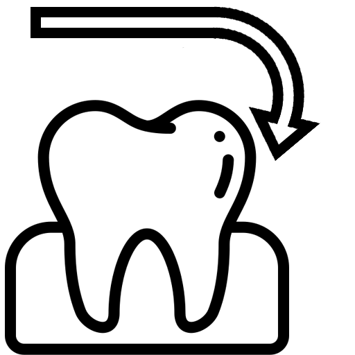 Бор для препарирования в небной и язычной плоскостях